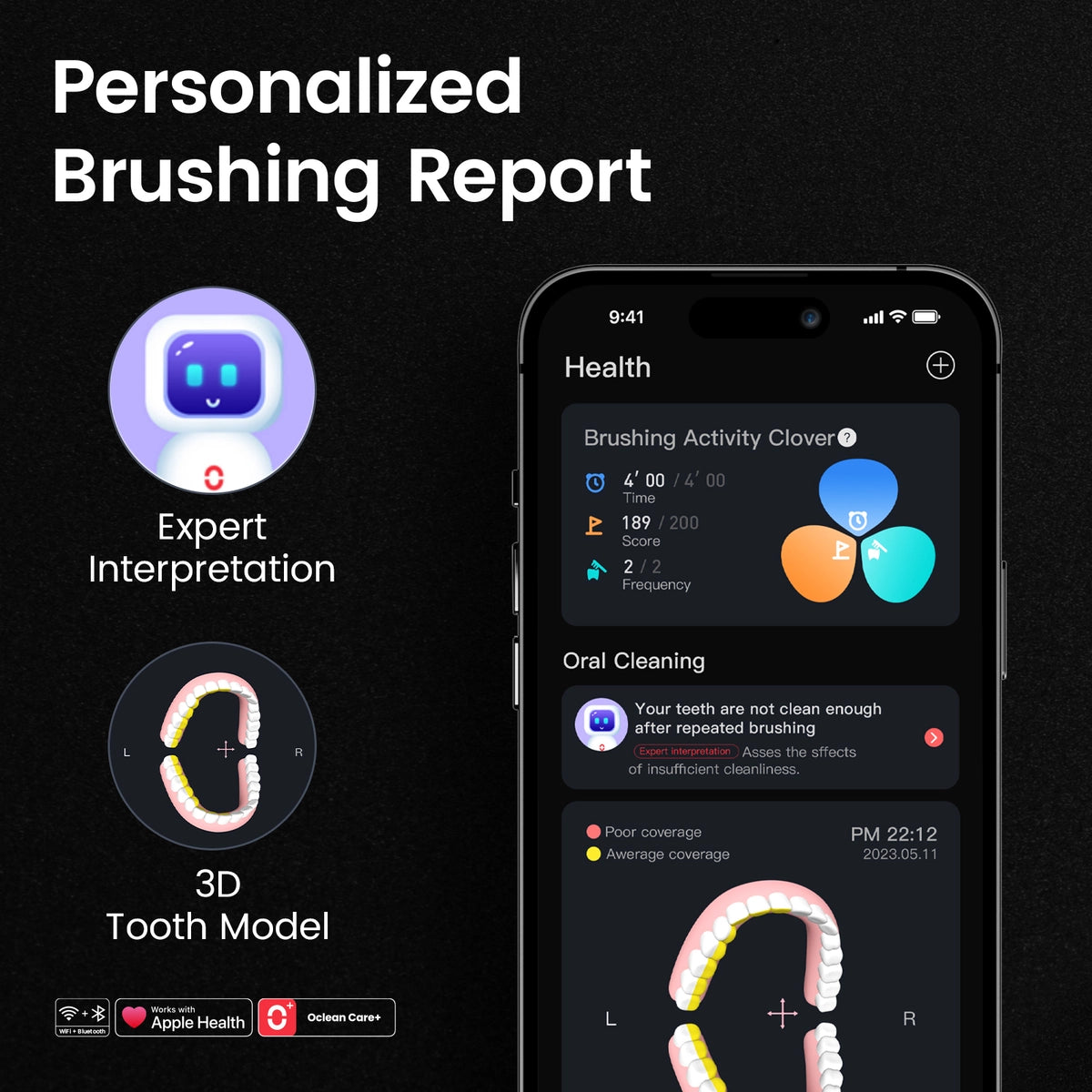 Oclean X Ultra S Sonic Toothbrush - Personalized Brushing Report
