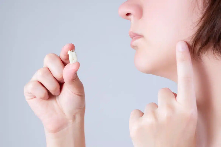 How to Speed Up Wisdom Teeth Recovery
