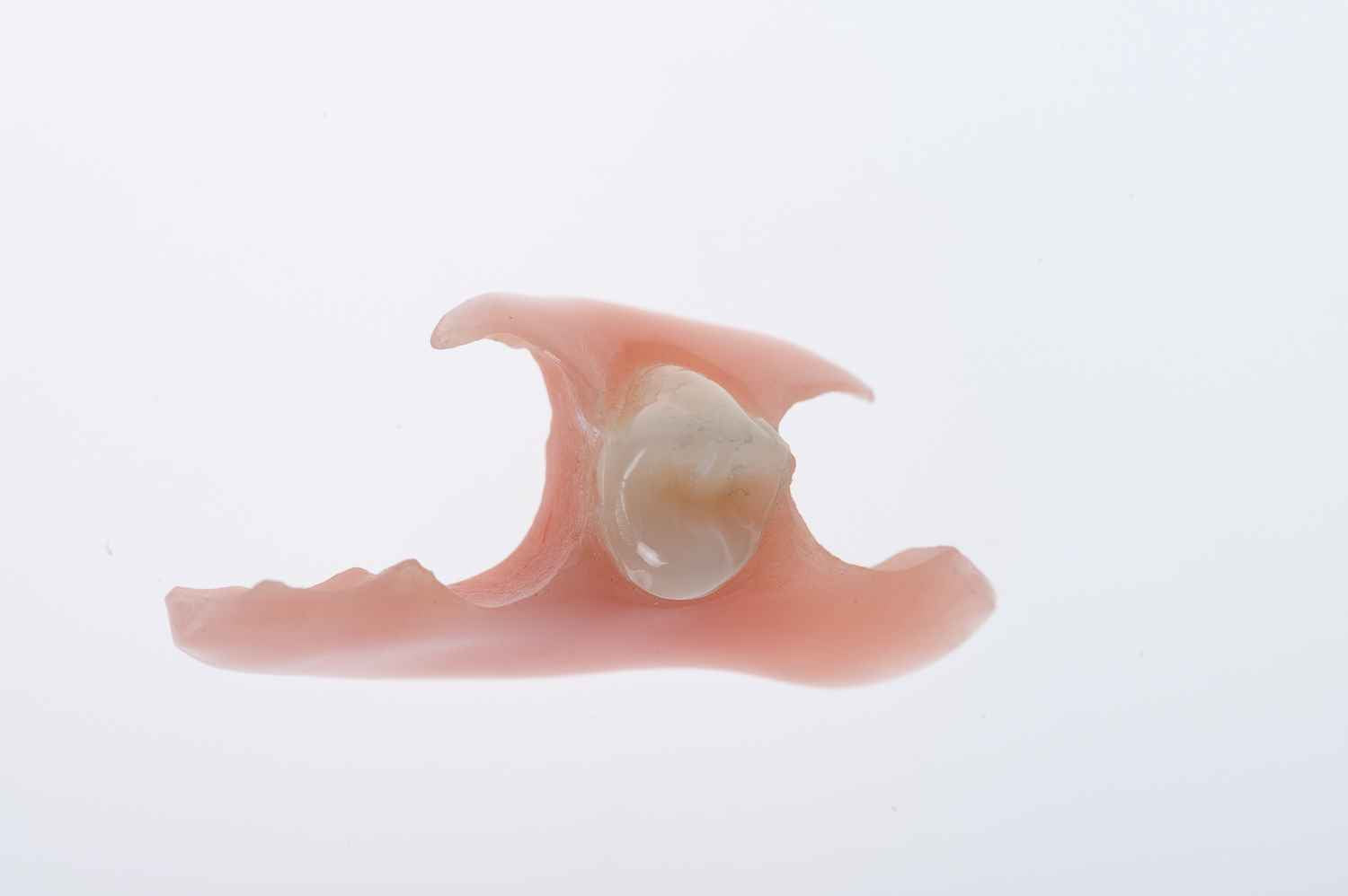 How a Single Tooth Denture Stays In?