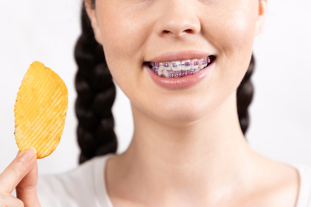 Can You Eat Chips with Braces? Tips & Safe Options