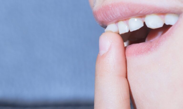 How to Tighten a Loose Tooth at Home?