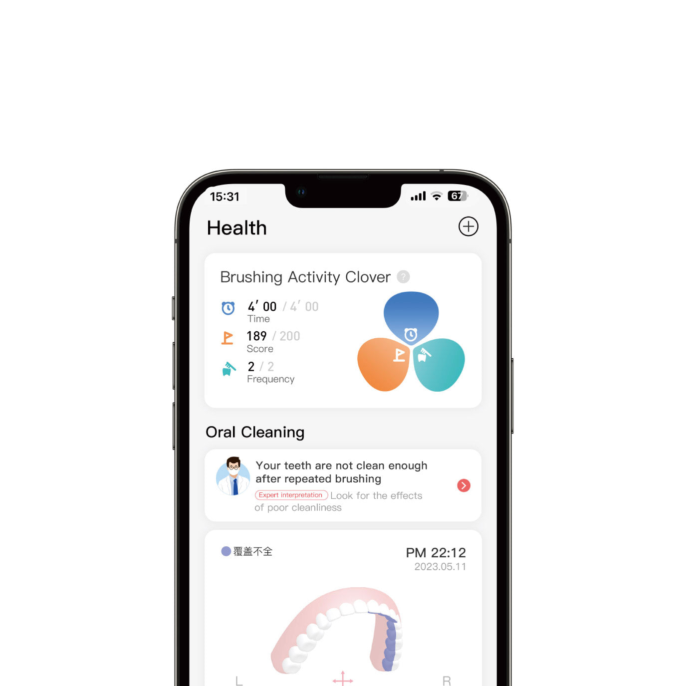 Oclean X Pro fogkefe Premium csomag - ma féláron kuponnal! 10 Oclean X Pro fogkefe utazótáskával
