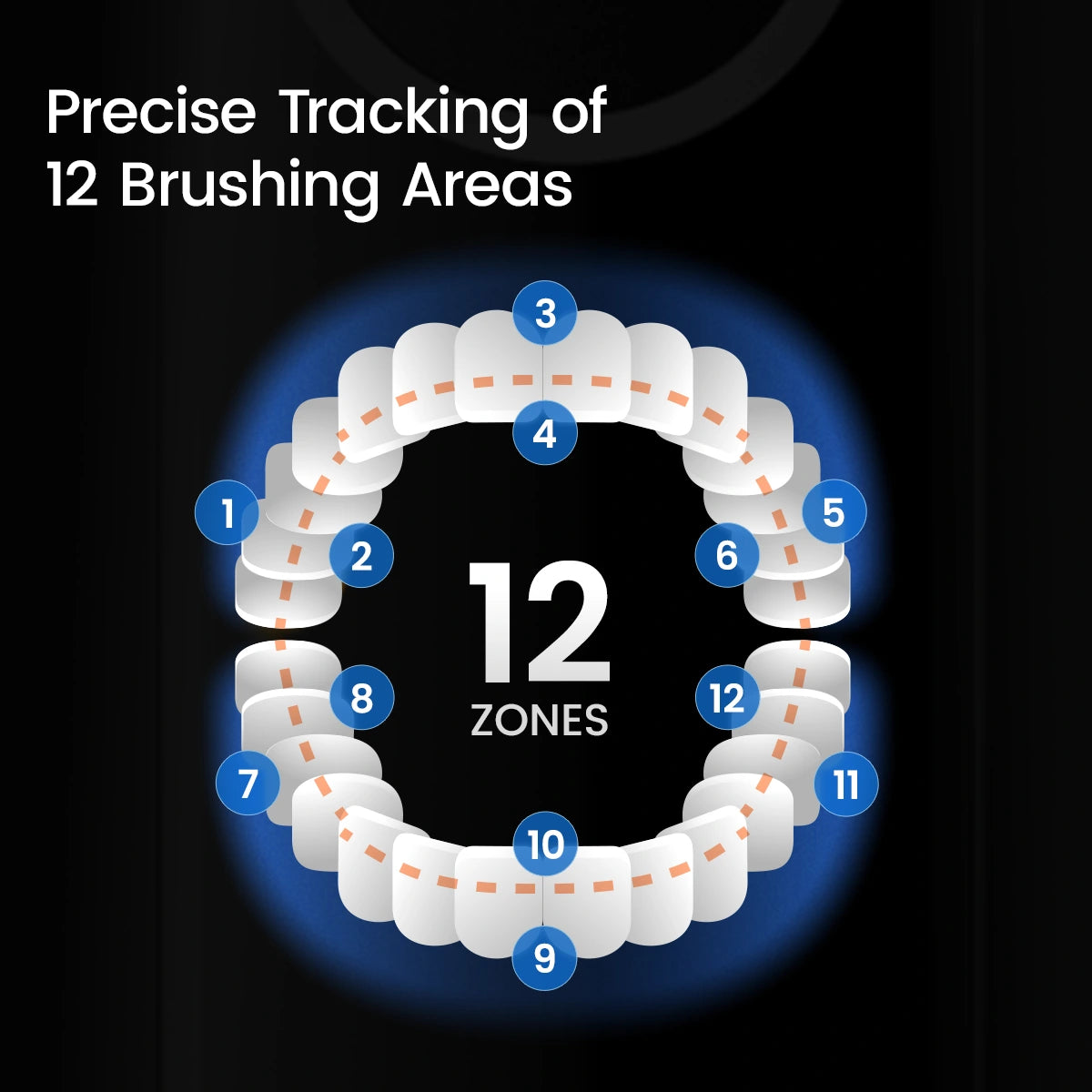X Pro 20-tracking