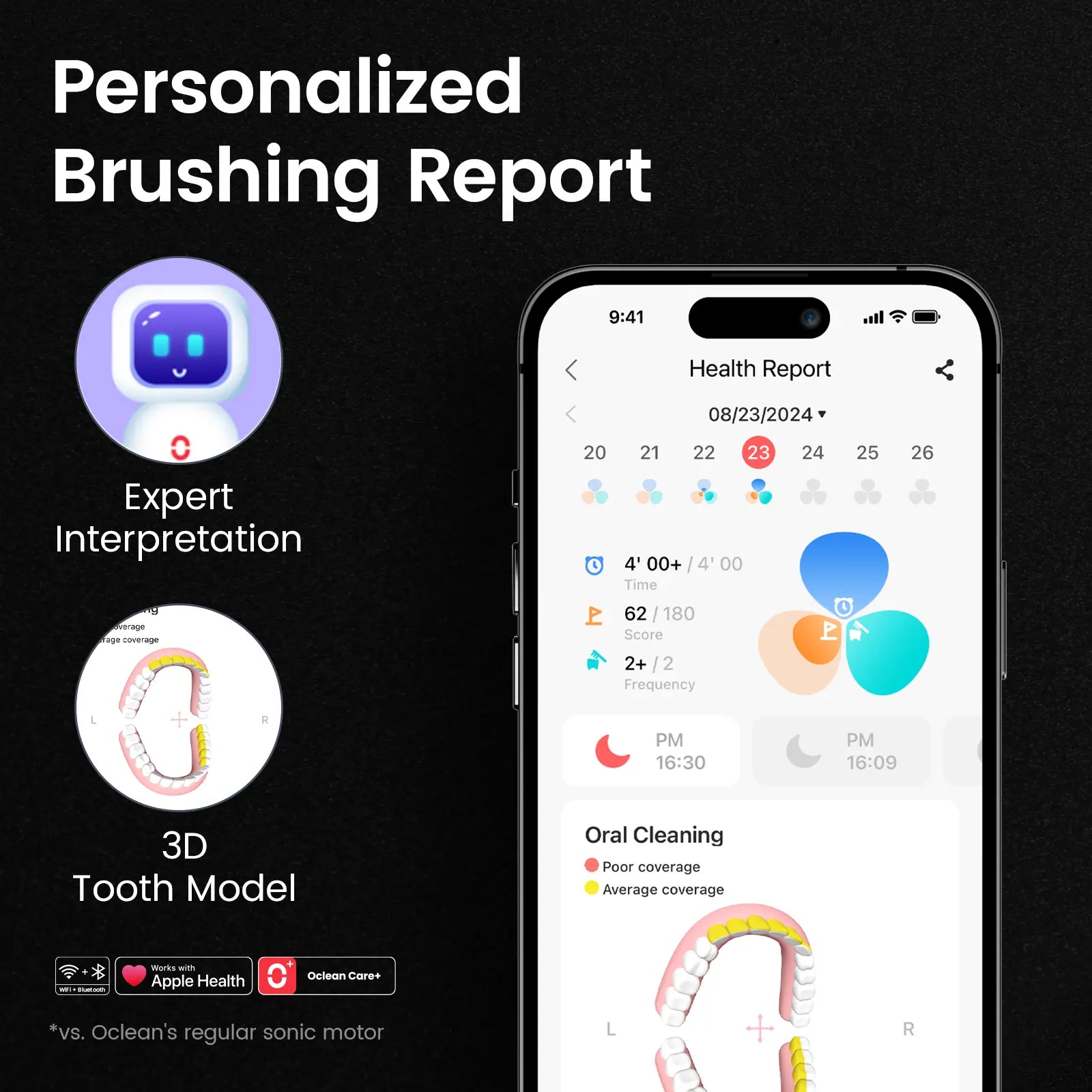 x-ultra-20-sonic-toothbrush-report